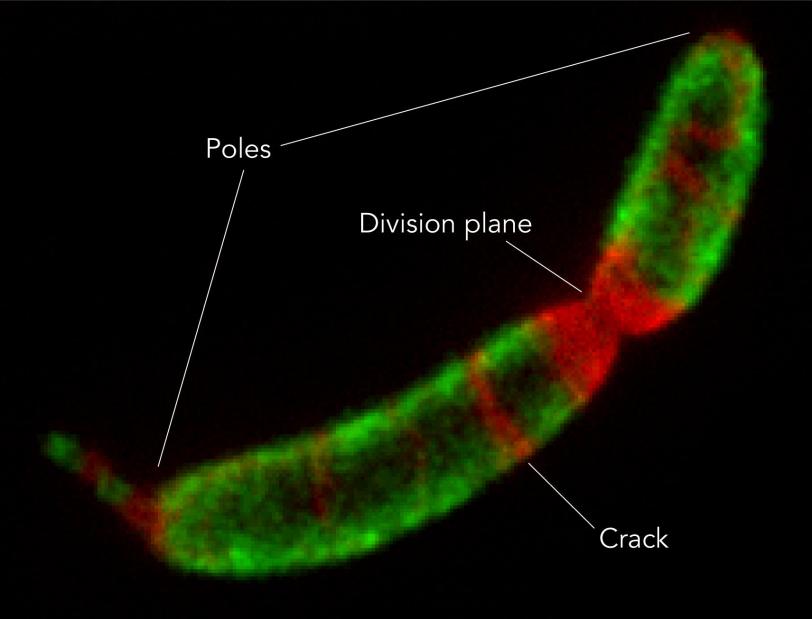 Image of microbe showing areas where its crystalline shell is growing 