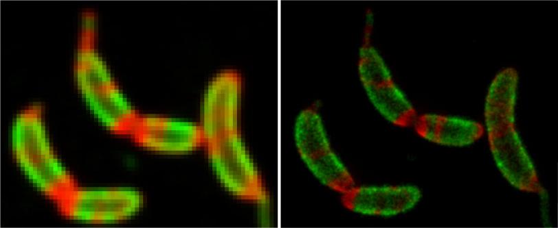 Comparison of two images shows sharper view obtained in this study