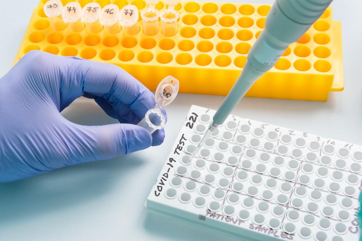 Coronavirus testing